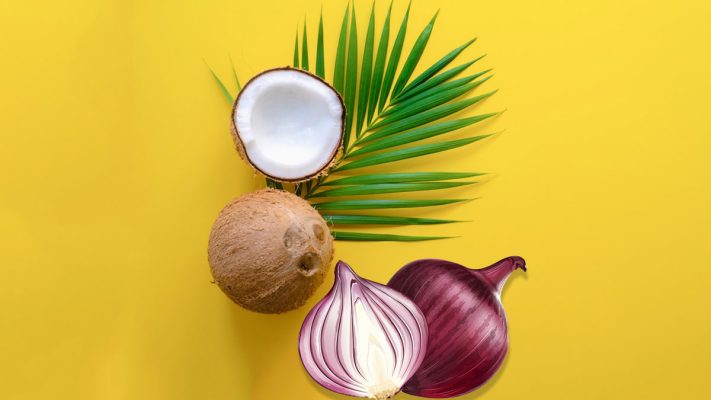 coconut oil and onion juice dandruff hacks e1765446645710